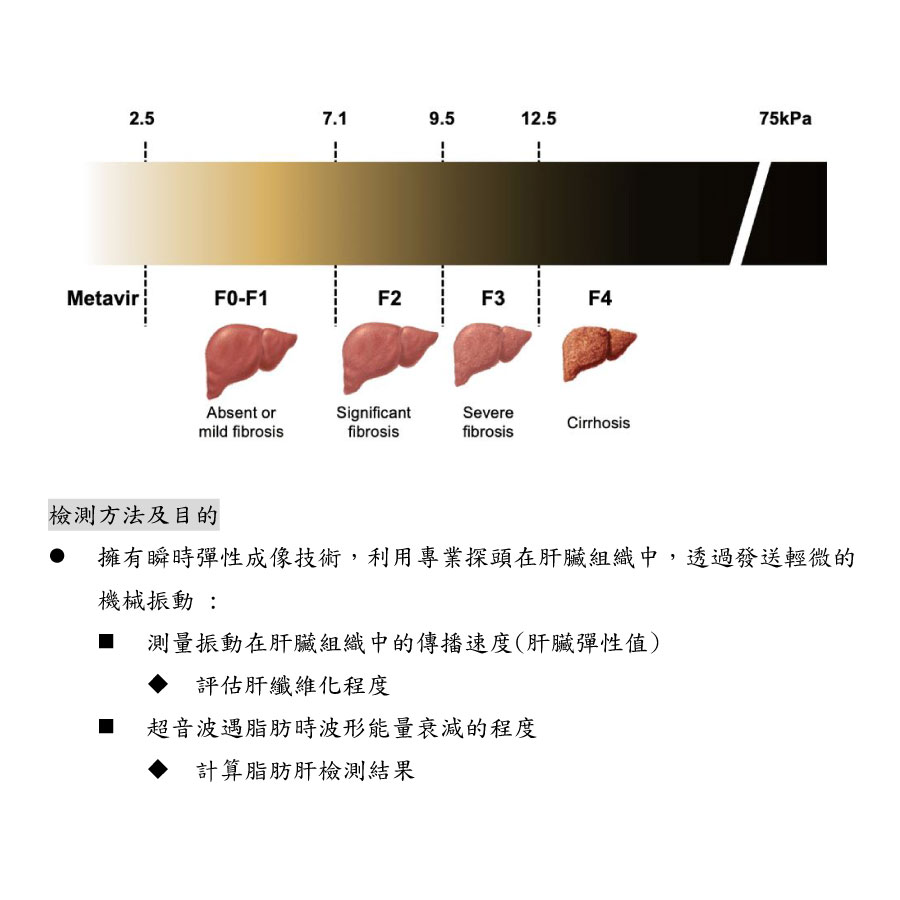 非侵入性肝臟硬化及脂肪肝檢測